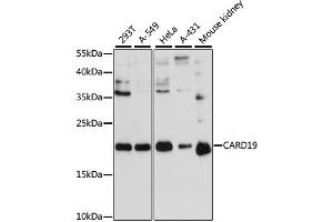 Western blot analysis of extracts of various cell lines, using CARD19 antibody. (C9orf89 Antikörper)