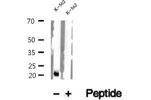 Western blot analysis of extracts of K-562 cells, using NDUFS7 antibody.