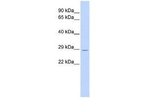 TRIM55 antibody used at 1 ug/ml to detect target protein. (TRIM55 Antikörper  (Middle Region))