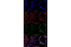 Immunocytochemistry/Immunofluorescence analysis using Mouse Anti-Hexanoyl-Lysine adduct Monoclonal Antibody, Clone 5D9 . (Hexanoyl-Lysine Adduct (HEL) Antikörper)