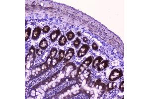 IHC analysis of FLIP using anti-FLIP antibody (ABIN5693075).