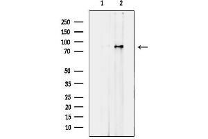anti-Intraflagellar Transport 81 Homolog (IFT81) antibody