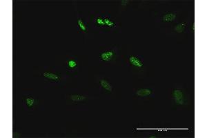 Immunofluorescence of purified MaxPab antibody to TCEB3 on HeLa cell. (TCEB3 Antikörper  (AA 1-772))