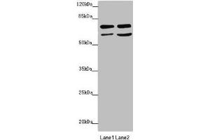 Western blot All lanes: VPS33B antibody at 2. (VPS33B Antikörper  (AA 348-617))