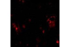 Immunofluorescence of DcR1 in rat liver tissue with AP30279PU-N DcR1 antibody at 10 μg/ml. (DcR1 Antikörper)