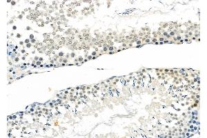 ABIN6263064 and ABIN6272512 at 1/100 staining Rat testis tissue by IHC-P.