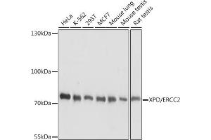 Western blot analysis of extracts of various cell lines, using XPD/ERCC2 antibody (ABIN7267056) at 1:1000 dilution. (ERCC2 Antikörper  (AA 1-180))