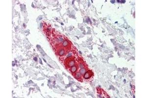 IHC testing of FFPE human colon tissue with FEZ1 antibody at 5ug/ml. (FEZ1 Antikörper)