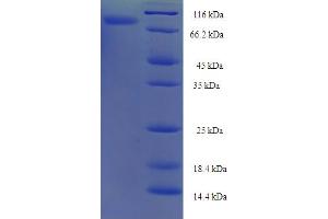 SDS-PAGE (SDS) image for Neurexophilin and PC-Esterase Domain Family, Member 3 (NXPE3) (AA 31-559) protein (His-SUMO Tag) (ABIN5711634) (FAM55C Protein (AA 31-559) (His-SUMO Tag))