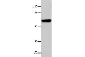 Western blot analysis of 293T cell, using CNGA2 Polyclonal Antibody at dilution of 1:500 (CNGA2 Antikörper)
