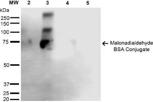 Western Blot analysis of Malondialdehyde-BSA Conjugate showing detection of 67 kDa Malondialdehyde -BSA using Mouse Anti-Malondialdehyde Monoclonal Antibody, Clone 6H6 . (Malondialdehyde Antikörper  (FITC))