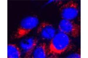 IF on PC12 cells at a concentration of 30 µg/ml using Rabbit antibody to 4th cytoplasmic loop of human TRPM7 (LTRPC7): IgG (ABIN351218), DAPI counterstained. (TRPM7 Antikörper  (4th Cytoplasmic Loop))