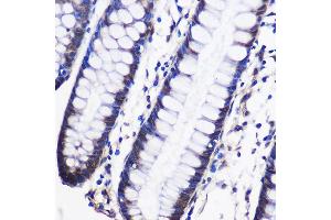 Immunohistochemistry (IHC) image for anti-CUGBP, Elav-Like Family Member 1 (CELF1) (AA 108-483) antibody (ABIN6138399)