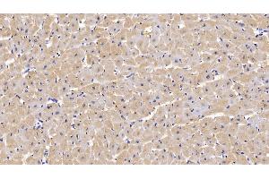 Immunohistochemistry (IHC) image for anti-Fatty Acid Binding Protein 3, Muscle and Heart (FABP3) (AA 1-133) antibody (ABIN7426238)