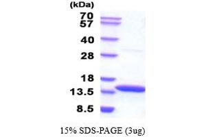 SDS-PAGE (SDS) image for Cystatin B (Stefin B) (CSTB) (AA 1-98) (Active) protein (His tag) (ABIN6387719)
