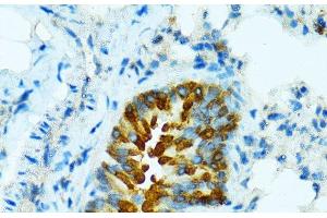 Immunohistochemistry of paraffin-embedded Mouse lung using CYP2B6 Polyclonal Antibody at dilution of 1:100 (40x lens). (CYP2B6 Antikörper)