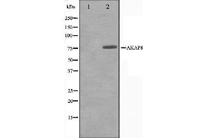 Western blot analysis on Jurkat cell lysate using AKAP8 Antibody,The lane on the left is treated with the antigen-specific peptide.