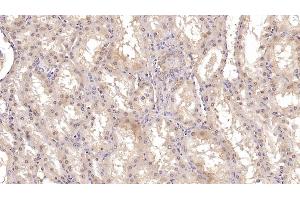 Immunohistochemistry (IHC) image for anti-Aspartate beta-Hydroxylase (ASPH) (AA 345-758) antibody (ABIN7427174)