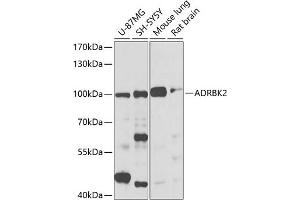 Western Blotting (WB) image for anti-Adrenergic, Beta, Receptor Kinase 2 (ADRBK2) (AA 1-300) antibody (ABIN3022787)