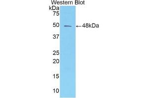 Western blot analysis of the recombinant protein. (AMBP Antikörper  (AA 20-202))
