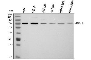 Western blot analysis of ARAF using anti-ARAF antibody (ABIN6719439).