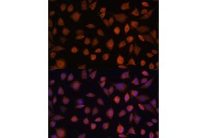 Immunofluorescence analysis of L929 cells using  antibody (ABIN7265674) at dilution of 1:100. (ARMC6 Antikörper  (AA 1-220))