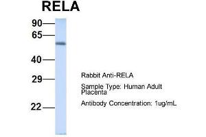 Host: Rabbit  Target Name: RELA  Sample Tissue: Human Adult Placenta  Antibody Dilution: 1.