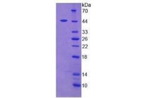 Mouse Detection antibody from the kit in WB with Positive Control: Human placenta tissue lysate.