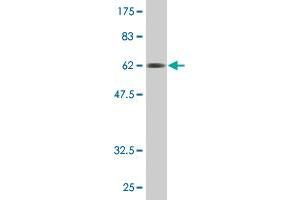 Western Blot detection against Immunogen (61. (FCER2 Antikörper  (AA 1-321))