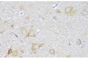 Immunohistochemistry of paraffin-embedded Rat brain using EDC3 Polyclonal Antibody at dilution of 1:150 (40x lens).