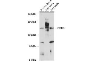 Western blot analysis of extracts of various cell lines, using CDH3 antibody (ABIN7269142) at 1:3000 dilution. (P-Cadherin Antikörper  (AA 24-350))