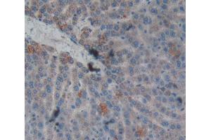 Used in DAB staining on fromalin fixed paraffin- embedded liver tissue (CPB2 Antikörper  (AA 164-417))