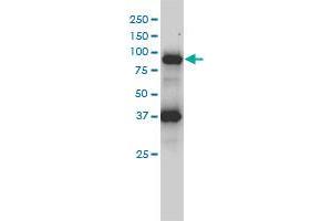 FES monoclonal antibody (M01), clone 3A3-1E5 Western Blot analysis of FES expression in HL-60 . (FES Antikörper  (AA 1-822))