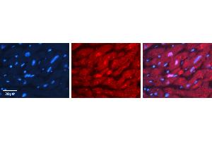 Immunohistochemistry (IHC) image for anti-Valosin Containing Protein (VCP) (C-Term) antibody (ABIN2788042)