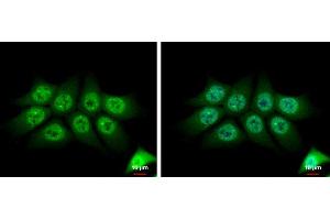 ICC/IF Image TMS1 antibody [N1C3] detects TMS1 protein at cytoplasm and nucleus by immunofluorescent analysis.