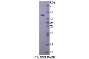 SDS-PAGE analysis of Mouse ALDH1A1 Protein. (ALDH1A1 Protein)