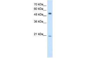 WB Suggested Anti-BLK Antibody Titration:  2. (BLK Antikörper  (Middle Region))