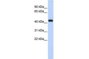 Image no. 1 for anti-TNF Receptor-Associated Factor 1 (TRAF1) (C-Term) antibody (ABIN6744361) (TRAF1 Antikörper  (C-Term))