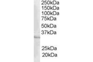 Image no. 1 for anti-CAMP Responsive Element Modulator (CREM) (C-Term) antibody (ABIN374482) (CREM Antikörper  (C-Term))