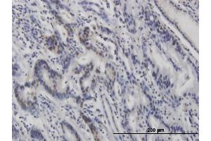 Immunohistochemistry (IHC) image for anti-Tumor Protein P53 (TP53) (pSer315) antibody (ABIN3201006) (p53 Antikörper  (pSer315))