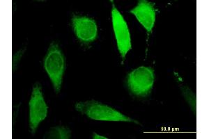 Immunofluorescence of monoclonal antibody to AGPAT6 on HeLa cell. (AGPAT6 Antikörper  (AA 39-137))