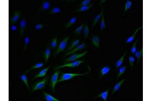 Immunofluorescent analysis of Hela cells using ABIN7170235 at dilution of 1:100 and Alexa Fluor 488-congugated AffiniPure Goat Anti-Rabbit IgG(H+L) (SLC35F5 Antikörper  (AA 122-242))