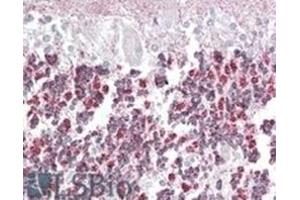 Image no. 2 for anti-Epilepsy, Progressive Myoclonus Type 2A, Lafora Disease (Laforin) (EPM2A) (Internal Region), (Isoform A) antibody (ABIN375087) (EPM2A Antikörper  (Internal Region, Isoform A))