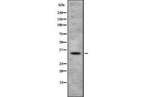 Western blot analysis OR4A47 using HeLa whole cell lysates (OR4A47 Antikörper  (Internal Region))