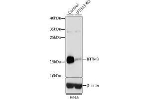 Western blot analysis of extracts from normal (control) and IFITM3 knockout (KO) HeLa cells, using IFITM3 antibody (ABIN6130482, ABIN6142186, ABIN6142187 and ABIN7101416) at 1:3000 dilution. (IFITM3 Antikörper  (AA 1-133))