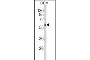 Western blot analysis of FLCN Antibody (Center) (ABIN652602 and ABIN2842404) in CEM cell line lysates (35 μg/lane). (FLCN Antikörper  (AA 325-354))
