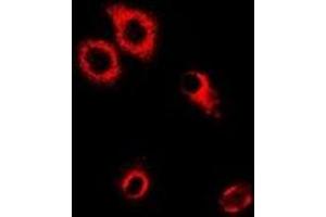 Immunofluorescent analysis of SerRS staining in MCF7 cells. (Seryl-tRNA Synthetase (SARS) Antikörper)