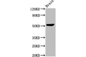 Western Blot Positive WB detected in: Mouse brain tissue All lanes: SLC30A10 antibody at 3 μg/mL Secondary Goat polyclonal to rabbit IgG at 1/50000 dilution Predicted band size: 53, 27, 25 kDa Observed band size: 53 kDa (SLC3A1 Antikörper  (AA 58-278))