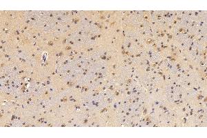 Immunohistochemistry (IHC) image for anti-Cytochrome P450, Family 1, Subfamily A, Polypeptide 1 (CYP1A1) (AA 251-521) antibody (ABIN7441016)