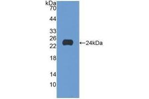 Detection of Recombinant SCFR, Human using Polyclonal Antibody to Stem Cell Factor Receptor (SCFR) (KIT Antikörper  (AA 321-520))